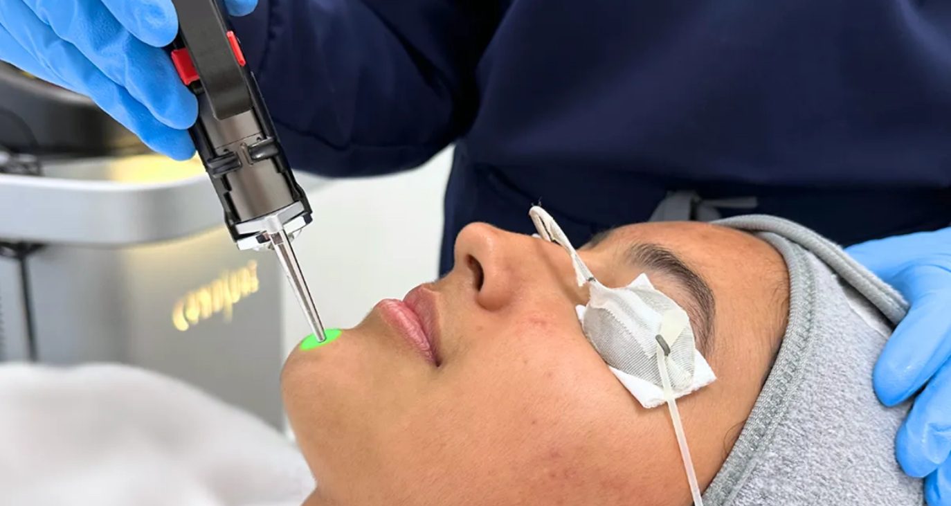 Woman having rf treatment