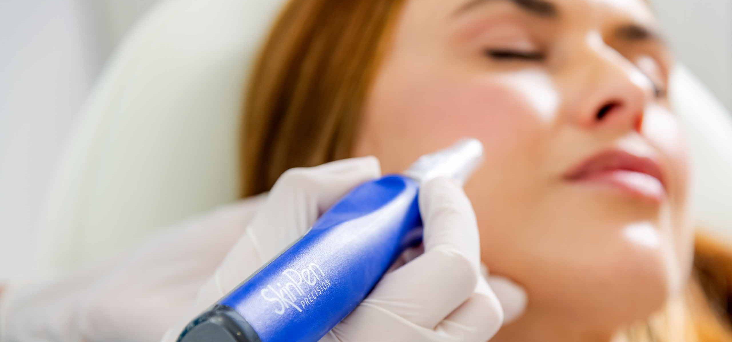 SkinPen MicroNeedling